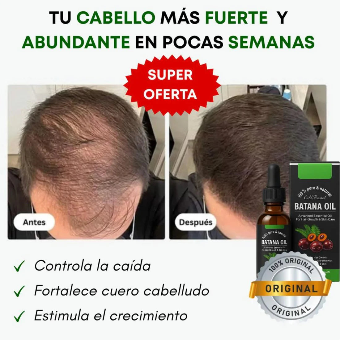 Aceite Batana™ 100% Puro con Romero y Maca Nutritivo Estimula el Crecimiento Capilar y Restaura el Cabello