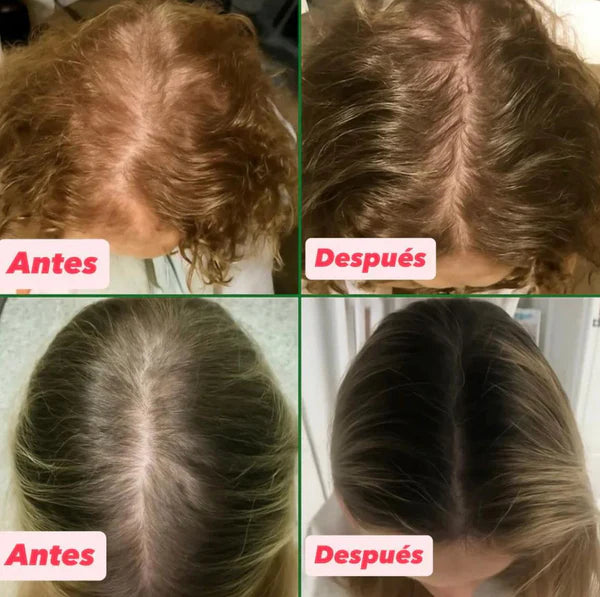 Aceite Batana™ 100% Puro con Romero y Maca Nutritivo Estimula el Crecimiento Capilar y Restaura el Cabello